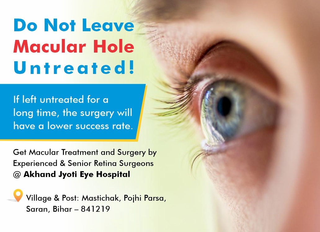 When Is It Too Late To Treat A Macular Hole Macular Hole Symptoms, Causes, & Treatment Options