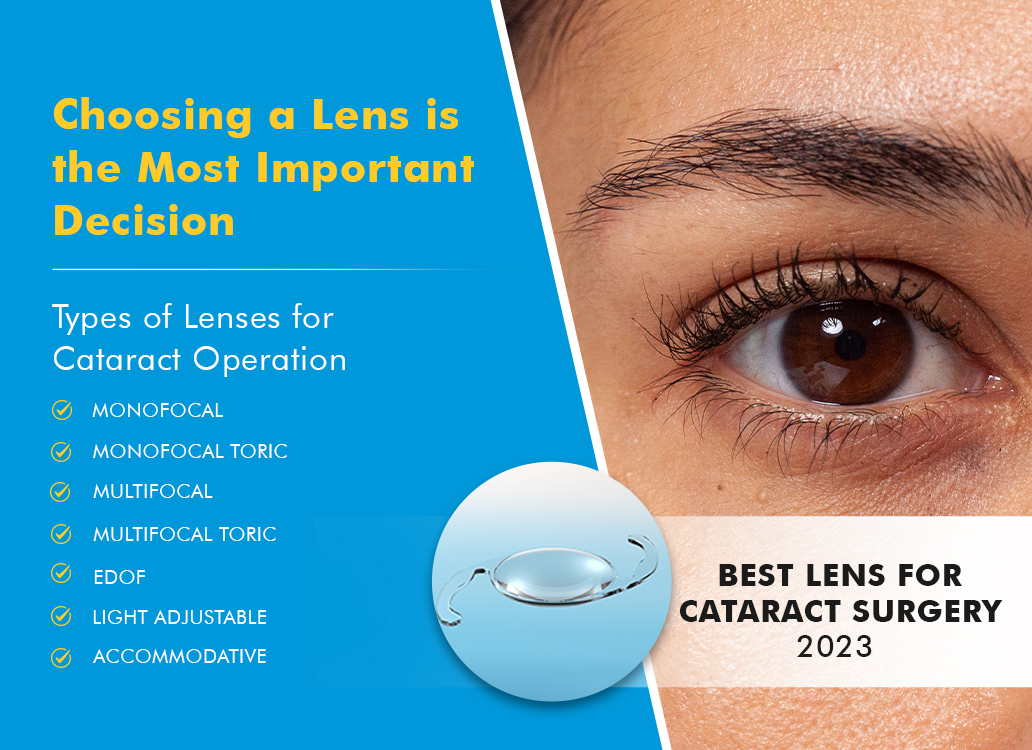 Best Lens for Cataract Surgery in 2023 Lens Types & Cost